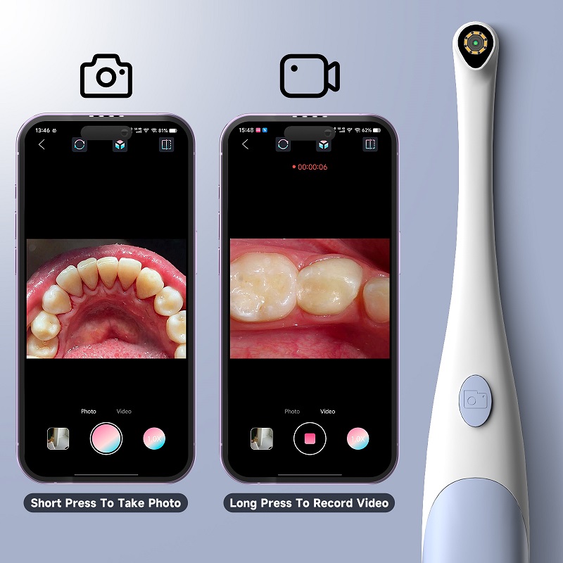Oral Endoscope Camera 1440P Ph - đánh giá và giá Photography Lighting Handheld